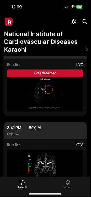 RAPID AI stroke detection showing LVO detected at NICVD Karachi